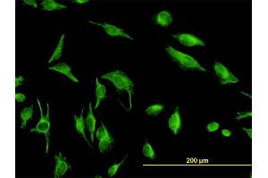 Immunofluorescence of monoclonal antibody to TPMT on HeLa cell. (TPMT antibody  (AA 1-245))