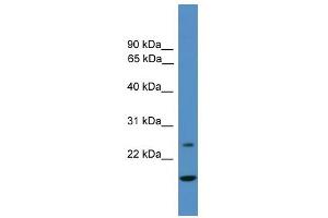 WB Suggested Anti-TFPI2 Antibody Titration: 0. (TFPI2 antibody  (N-Term))