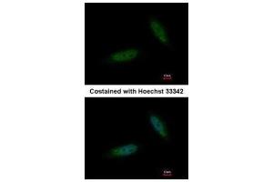 ICC/IF Image Immunofluorescence analysis of paraformaldehyde-fixed HeLa, using TBCK, antibody at 1:200 dilution. (TBCK antibody)