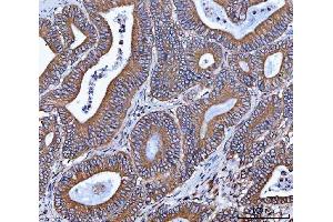 IHC analysis of VAPA using anti-VAPA antibody (ABIN7603249). (VAPA antibody  (N-Term))