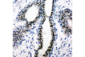 Immunohistochemistry (Paraffin-embedded Sections) (IHC (p)) image for anti-Estrogen Receptor 1 (ESR1) (AA 425-595) antibody (ABIN3042378) (Estrogen Receptor alpha antibody  (AA 425-595))