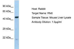 Host:  Rabbit  Target Name:  Rfx6  Sample Type:  Mouse Liver lysates  Antibody Dilution:  1.