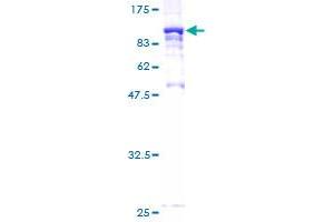 Image no. 1 for Syntaxin Binding Protein 2 (STXBP2) (AA 1-590) protein (GST tag) (ABIN1321813) (STXBP2 Protein (AA 1-590) (GST tag))