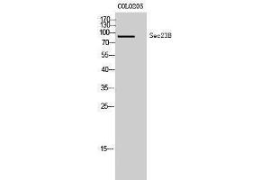 Western Blotting (WB) image for anti-Sec23 Homolog B (SEC23B) (Internal Region) antibody (ABIN3186891) (Sec23 Homolog B antibody  (Internal Region))