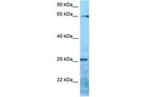 Image no. 1 for anti-Villin-Like (VILL) (AA 176-225) antibody (ABIN6748301) (VILL antibody  (AA 176-225))