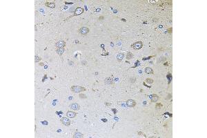 Immunohistochemistry of paraffin-embedded rat brain using MEMO1 antibody  at dilution of 1:100 (40x lens). (MEMO1 antibody  (AA 1-297))