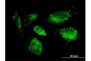 Immunofluorescence of purified MaxPab antibody to SQSTM1 on HeLa cell. (SQSTM1 antibody  (AA 1-440))