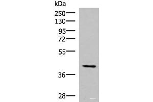 Western blot analysis of Hela cell lysate using IST1 Polyclonal Antibody at dilution of 1:1000 (IST1 antibody)