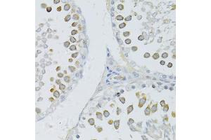 Immunohistochemistry of paraffin-embedded rat testis using PIWIL2 antibody (ABIN4904371) at dilution of 1:100 (40x lens).