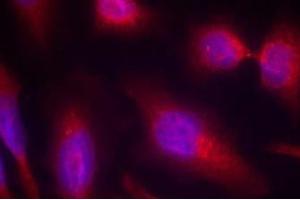 Image no. 1 for anti-Microtubule-Associated Protein tau (MAPT) (Ser214) antibody (ABIN401618)