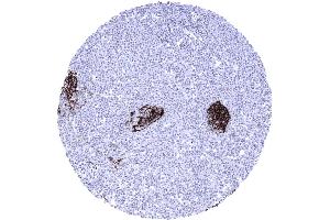 anti-Fc Fragment of IgE, Low Affinity II, Receptor For (CD23) (FCER2) (AA 48-321) antibody