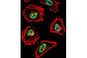 Fluorescent confocal image of Hela cell stained with (MOUSE) Ncor1 Antibody (ABIN387976 and ABIN2844785). (NCOR1 antibody  (N-Term))