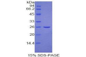 SDS-PAGE (SDS) image for Nucleolin (NCL) (AA 388-569) protein (His tag) (ABIN2123852) (Nucleolin Protein (NCL) (AA 388-569) (His tag))
