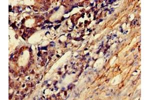 Immunohistochemistry of paraffin-embedded human smooth muscle tissue using ABIN7160538 at dilution of 1:100 (MYLK antibody  (AA 290-398))