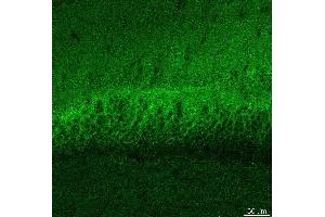 Indirect immunostaining PFA fixed hippocampus sections (dilution 1 : 500). (DLG3 antibody)