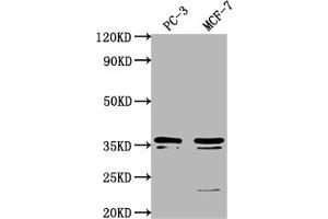 Western Blot Positive WB detected in: PC-3 whole cell lysate, MCF-7 whole cell lysate All lanes: OR6C1 antibody at 1:1000 Secondary Goat polyclonal to rabbit IgG at 1/50000 dilution Predicted band size: 36 kDa Observed band size: 36 kDa (OR6C1 antibody  (AA 259-275))