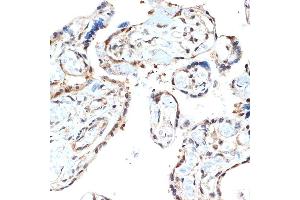 Immunohistochemistry of paraffin-embedded human placenta using PSM Rabbit mAb (ABIN7269597) at dilution of 1:100 (40x lens).