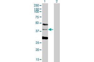 Western Blot analysis of CSDA expression in transfected 293T cell line by CSDA MaxPab polyclonal antibody. (CSDA antibody  (AA 1-372))