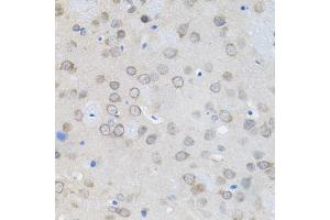 Immunohistochemistry of paraffin-embedded rat brain using UBE2A antibody (ABIN6132760, ABIN6149782, ABIN6149784 and ABIN6223686) (40x lens).