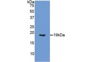 Western blot analysis of recombinant Human ANGPT1. (Angiopoietin 1 antibody  (AA 284-452))