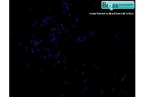 Mouse embryonic cortex cells labeled with RABBIT ANTI-SATB2 POLYCLONAL ANTIBODY Polyclonal Antibody, conjugated followed by DAPI staining. (SATB2 antibody  (AA 451-485))