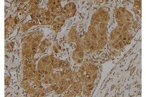 ABIN6275025 at 1/100 staining Human kidney tissue by IHC-P. (CCDC102B antibody  (Internal Region))