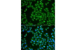 Immunofluorescence analysis of A549 cell using MAP4K3 antibody. (MAP4K3 antibody)