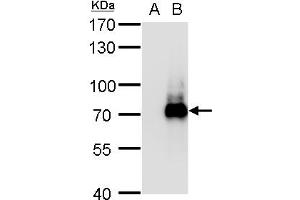 WB Image TRIM32 antibody detects TRIM32 protein by western blot analysis. (TRIM32 antibody)