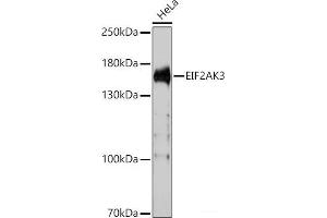Western blot analysis of extracts of HeLa cells using EIF2AK3 Polyclonal Antibody at dilution of 1:1000. (PERK antibody)
