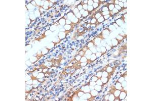 Immunohistochemistry of paraffin-embedded human colon using HHL antibody (ABIN6132190, ABIN6141750, ABIN6141751 and ABIN6217197) at dilution of 1:100 (40x lens). (HHLA2 antibody  (AA 30-200))