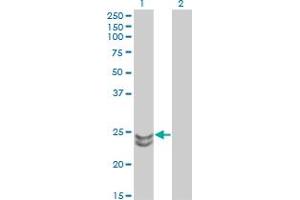 Western Blotting (WB) image for anti-RAB27A, Member RAS Oncogene Family (RAB27A) (AA 122-222) antibody (ABIN598569) (RAB27A antibody  (AA 122-222))