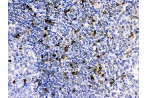 Immunohistochemistry (IHC) image for anti-Apolipoprotein B mRNA Editing Enzyme, Catalytic Polypeptide-Like 3G (APOBEC3G) (AA 191-384) antibody (ABIN4886468)
