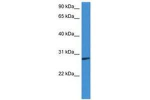 Image no. 1 for anti-Complement Factor D (CFD) (AA 160-209) antibody (ABIN6746774) (Adipsin antibody  (AA 160-209))