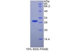 SDS-PAGE (SDS) image for Tafazzin (TAZ) (AA 46-239) protein (His tag) (ABIN2126917)