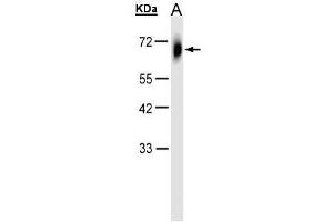 WB Image Sample(30 μg of whole cell lysate) A:HeLa S3, 10% SDS PAGE antibody diluted at 1:1000 (TRIM23 antibody  (N-Term))