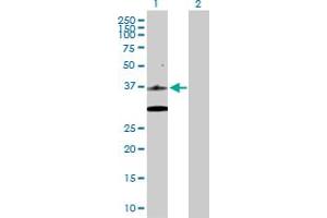 Western Blot analysis of CDK6 expression in transfected 293T cell line by CDK6 MaxPab polyclonal antibody. (CDK6 antibody  (AA 1-326))
