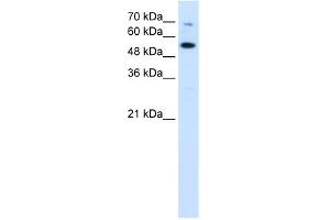 WB Suggested Anti-CHEK2 Antibody Titration:  0.