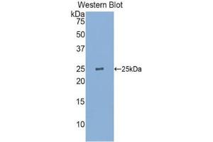 Detection of Recombinant GSTp, Human using Polyclonal Antibody to Glutathione S Transferase Pi (GSTp) (GSTP1 antibody  (AA 1-210))