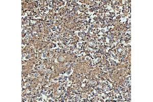 IHC analysis of Actin using anti-Actin antibody (ABIN3043519).