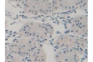 Immunohistochemistry (IHC) image for anti-Ubiquitin A-52 Residue Ribosomal Protein Fusion Product 1 (UBA52) (AA 1-128) antibody (ABIN7441190)