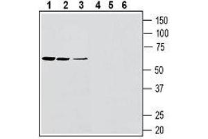 Western blot analysis of rat spleen lysates (lanes 1 and 4), rat lung membranes (lanes 2 and 4) and mouse lung membranes (lanes 3 and 6): - 1-3.