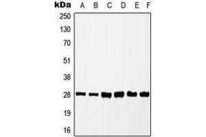 Western blot analysis of CK2 beta (pS209) expression in HEK293T (A), MCF7 (B), HepG2 (C), K562 (D), mouse liver (E), rat spleen (F) whole cell lysates. (CSNK2B antibody  (C-Term, pSer209))