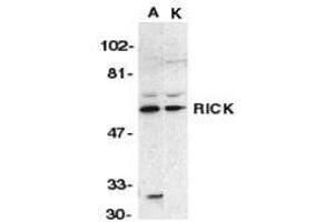 Western Blotting (WB) image for anti-ROP Interactive Partner 2 (RIP2) (N-Term) antibody (ABIN2476367) (RIP2 antibody  (N-Term))
