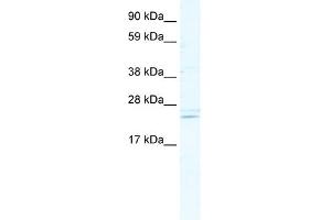 WB Suggested Anti-ASCL2 Antibody Titration:  5. (ASCL2 antibody  (C-Term))