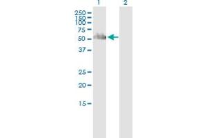 Western Blot analysis of PNKP expression in transfected 293T cell line by PNKP polyclonal antibody (A01). (PNKP antibody  (AA 422-521))