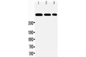 Anti-Laminin 2 alpha antibody, Western blotting Lane 1: HELA Cell Lysate Lane 2: A549 Cell Lysate Lane 3: PANC Cell Lysate (Laminin antibody  (N-Term))