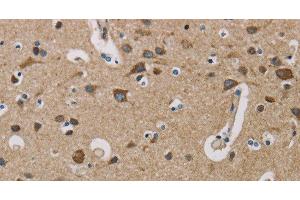 Immunohistochemistry of paraffin-embedded Human brain using COX6B1 Polyclonal Antibody at dilution of 1:50 (COX6B1 antibody)