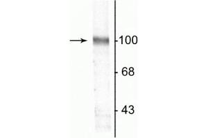 Western blot of a rat hippocampal lysate showing the specific immunolabeling of the ~100 kDa GluR2 protein. (GRIA2 antibody)