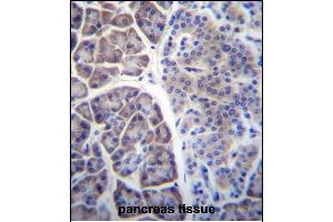 COPS7A Antibody (C-term) (ABIN656737 and ABIN2845961) immunohistochemistry analysis in formalin fixed and paraffin embedded human pancreas tissue followed by peroxidase conjugation of the secondary antibody and DAB staining.