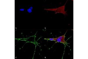 Immunocytochemistry/Immunofluorescence analysis using Mouse Anti-GluN1/NR1 Monoclonal Antibody, Clone S308-48 (ABIN2483591). (GRIN1/NMDAR1 antibody  (AA 42-361) (FITC))